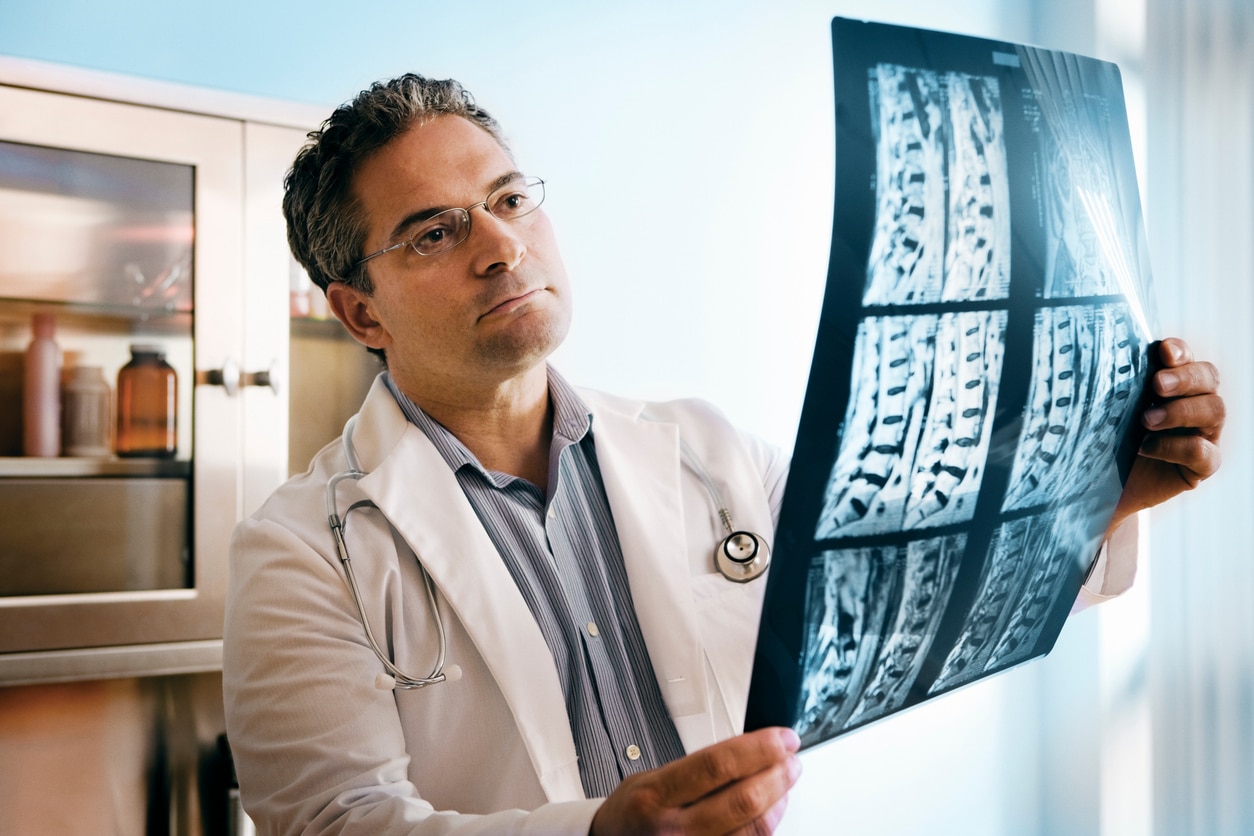 Doctor examines MRI images of spinal cord
